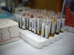 Este es el primer caso que los CDC detectan por transmisión sexual en Estados Unidos. AFP / J. Ordoñez