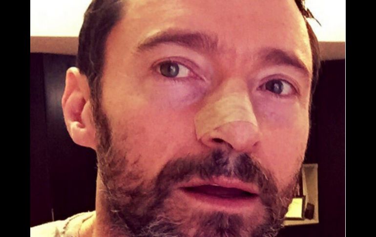Jackman informó en redes sociales que nuevamente estaba siendo tratado y publicó una fotografía. TWITTER / @RealHughJackman