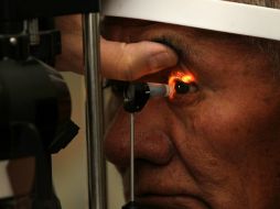 Otras causas de visión doble monocular incluyen córnea irregular, catarata o retinopatía. EFE / ARCHIVO