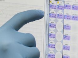 Aunque el zika no es mortal, ha sido vinculado a enfermedades como el síndrome de Guillain Barré y microcefalia en bebés. AP / ARCHIVO