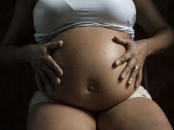 ''El aborto no es la respuesta al virus del zika, tenemos que valorar la vida en cualquier situación o circunstancia'', dicen. AP / ARCHIVO