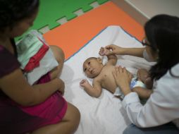 Autoridades esperan un repunte de casos de microcefalia para abril o mayo. AP / ARCHIVO
