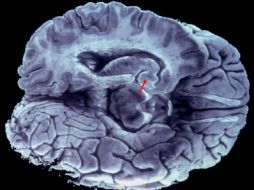 Señalan que mantener un cerebro grande tiene un coste metabólico significativo. EFE / ARCHIVO