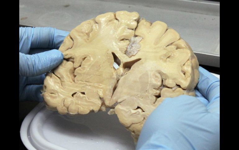 Señalan que el consumo de carbohidratos puede causar daño al sistema nervioso, a las neuronas y al hipocampo. NTX / ARCHIVO