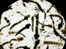 Indican que el virus, transmitidos por un mosquito, aumentaría conforme lleguen las lluvias ya que favorecen la cría de larvas. EFE / J. Arguedas