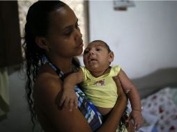 Según autoridades de salud colombianas, el zika afecta al bebé incluso en el segundo trimestre del embarazo. AP / A. Penner