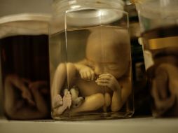 Pruebas detectaron en el feto material genético del virus zika en el tejido cerebral y el líquido amniótico. EL INFORMADOR / ARCHIVO
