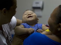 El síndrome es causado por una respuesta inmune anormal a una infección. AP / ARCHIVO