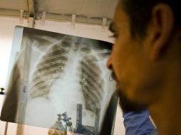 Cada paciente accidentando sufre traumatismos en hasta cinco o seis huesos. EFE / ARCHIVO