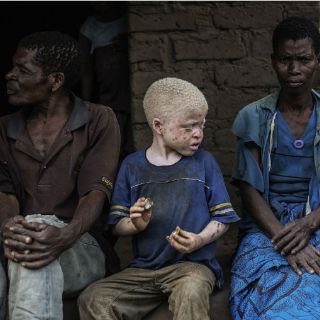 Queman vivas a siete personas en Malaui