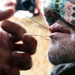 Refugiados se cosen la boca como protesta en Francia