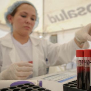 Mujeres en edad reproductiva, más vulnerables al VIH