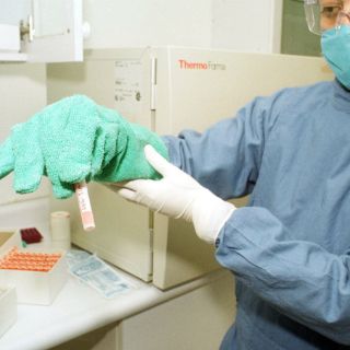 Hallan detalles de cómo células especializadas vuelven a ser células madre