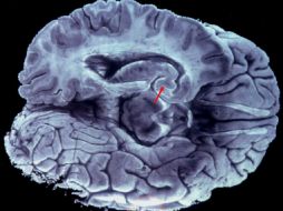 Cuando el proceso de las células del cerebro no funciona, puede dificultarse el reconocimiento de palabras. EFE / ARCHIVO