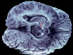 El lóbulo9 frontal está al mando del cerebro, pero situaciones como las señaladas, reducen su eficiencia. EFE / ARCHIVO