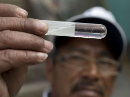 La OMS señala que se ha reportado un aumento de casos de microcefalia fetal en Brasil, la Polinesia, EU y Eslovenia. AP / ARCHIVO