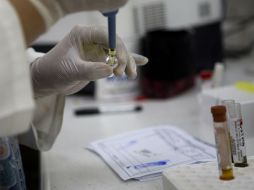 Investigadores tratan de comprender mejor cuánto tiempo puede permanecer el virus en el organismo. AP / ARCHIVO