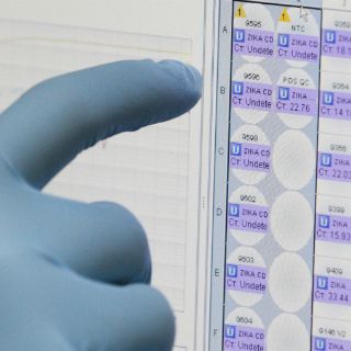 Zika dañaría células madre a través de una proteína: estudio