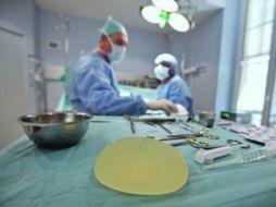 La cirugía brinda confianza y mejora la autoestima de las pacientes. EFE / ARCHIVO