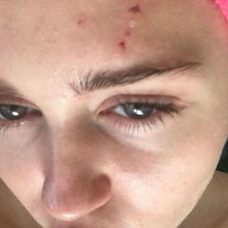 Miley Cyrus es atacada por un gato