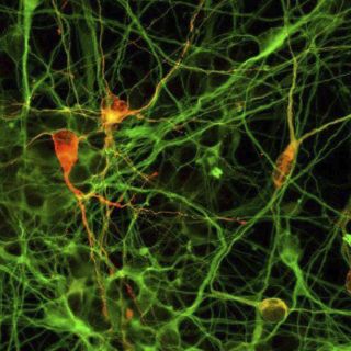 Descubren mecanismo del cerebro para eliminar neuronas muertas