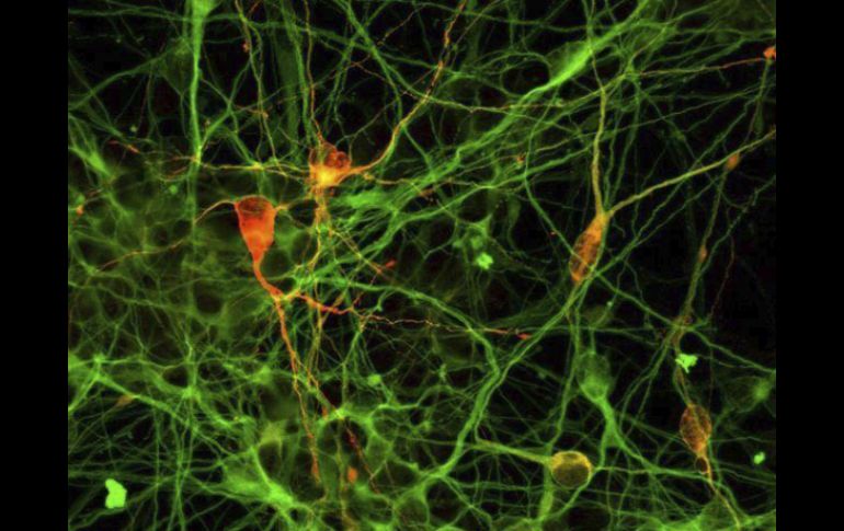 El hallazgo podría ser una opción terapéutica contras las enfermedades neurodegenerativas. EFE / ARCHIVO