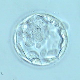 Modifican embriones humanos para hacerlos inmunes al VIH