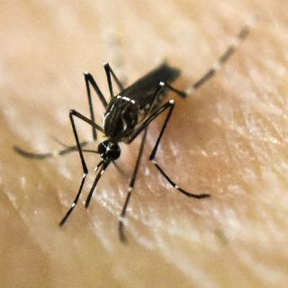 Confirman vínculo entre virus zika y microcefalia en fetos