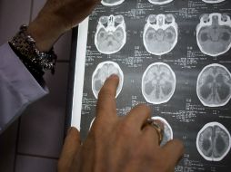 Bajo los esfectos del LSD el cebrro de integra o se unifica. NTX / ARCHIVO