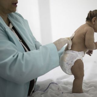 Aún deben hacerse más pruebas entre zika y microcefalia: OMS