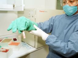 El impacto de la investigación aumentará la capacidad de discentir entre dos sistemas de diferenciación celular. NTX / ARCHIVO