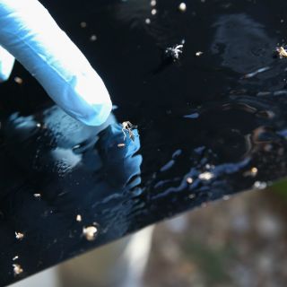 Honduras reporta 71 casos de Guillain-Barré vinculados con zika