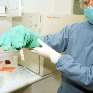 Células madre ayudarían a enfermedades neurodegenerativas