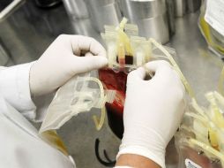 Se podría ocasionar discapacidad física, limitaciones funcionales y atrofia muscular. EL INFORMADOR / ARCHIVO