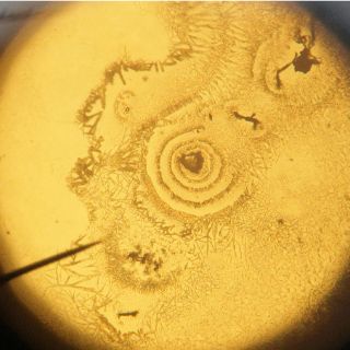 Hallan nanopartícula que oculta un alérgeno para tratar el asma