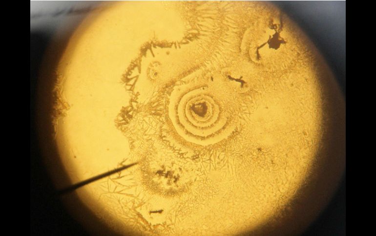 La nanopartícula podría emplearse también contra alergias alimentarias. EFE / ARCHIVO