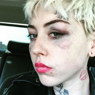 Golpean a autora de pintura de Donald Trump desnudo