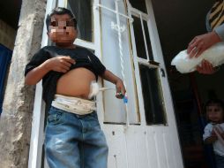 José Eduardo, de tan sólo 11 años de edad, padece insuficiencia renal y debe someterse a diálisis peritoneal. EL INFORMADOR / M. Vargas