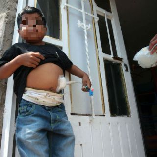 Poncitlán arrastra misterio por males renales en niños; Salud inicia estudios