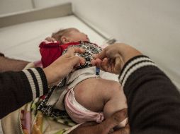 La enfermedad no siempre se relaciona con un desorden genético y por ello un especialista debe diagnosticarlo. EL INFORMADOR / ARCHIVO