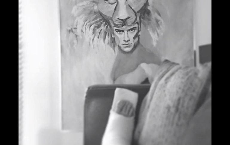 Durante una semana no podrá apoyar la pierna derecha . TWITTER / @_CarlosRivera