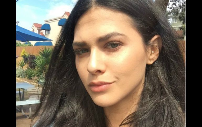 Adams sube a su cuenta de Instagram una fotografía con el ojo morado, consecuencia del accidente. INSTAGRAM / thejessadams