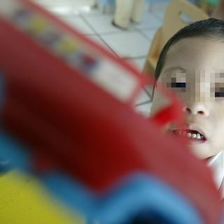 Identifican gen del Síndrome de Down vinculado a diabetes tipo 2