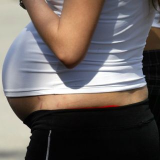 Belice registra primer caso de embarazada con zika