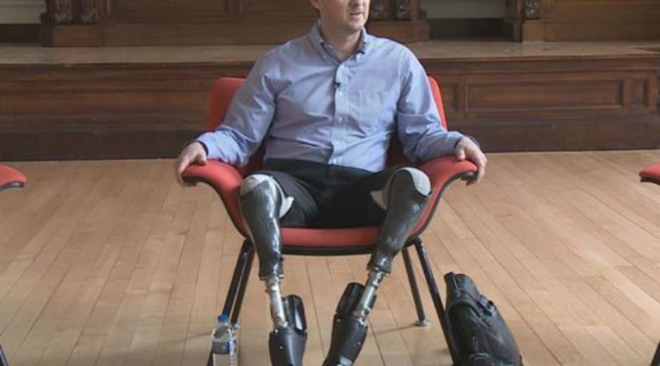 Ha diseñado para él mismo unas piernas especiales que le han permitido seguir practicando la escalada. ESPECIAL /