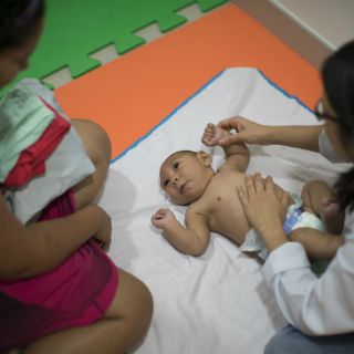 Brasil confirma mil 551 casos de microcefalia asociados al zika