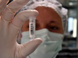 Muchas personas pueden ser portadoras sin manifestar la enfermedad; esta condición genética pasa desapercibida en el historial médico. AFP / ARCHIVO