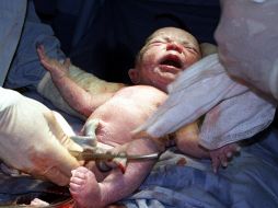 El jefe de la Sociedad Portuguesa de Obstetricia dijo que el nacimiento fue 'una hazaña extraordinaria'. EL INFORMADOR / ARCHIVO