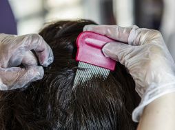 Durante el año las épocas más álgidas o los picos más altos de pediculosis se dan durante el verano y al inicio de cada ciclo escolar. EL INFORMADOR / ARCHIVO