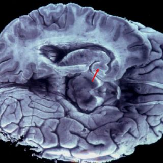 Descubren 'atajo' que usa el cerebro para advertir de riesgos
